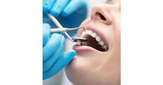 Dentalhygiene und Kontrolle inkl. 2 Röntgenbilder und zahnärztlicher Untersuchung